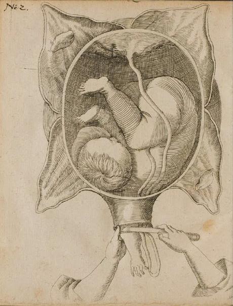 Obstetrix, la comadrona en la antigua Roma Obstetrix, la comadrona en la antigua Roma