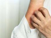 antihipertensivos inducen dermatitis adultos mayores