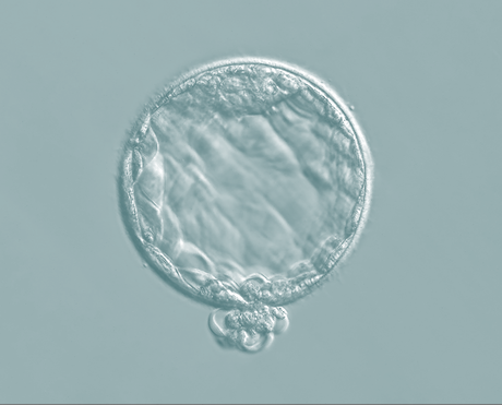 Desarrollan sitio web que estima la probabilidad de tener hijos mediante reproducción asistida Imagen comunicado