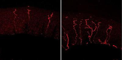 Descubren una proteína que regula la sensibilidad al dolor