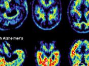 'Mens sana corpore sano' libre Alzheimer…