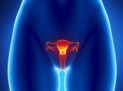 Riesgo carcinoma células renales post-histerectomía