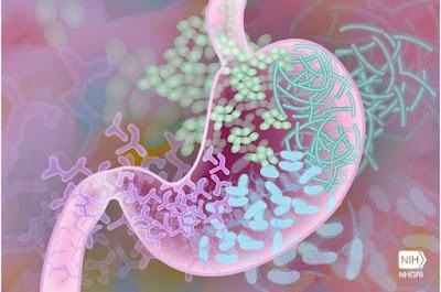 Ciertas Bacterias del intestino están implicadas en la obesidad Ciertas Bacterias del intestino están implicadas en la obesidad