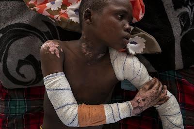 Darfur bajo asedio, un callejón sin salida.