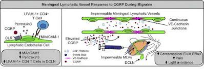 La migraña es causada por un mal drenaje linfático en el cerebro
