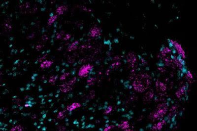 Evidencian nuevo objetivo para tratar el dolor crónico