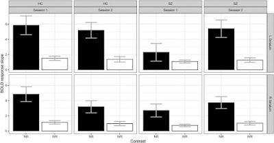 Científicos descifran las bases neuronales de la Esquizofrenia