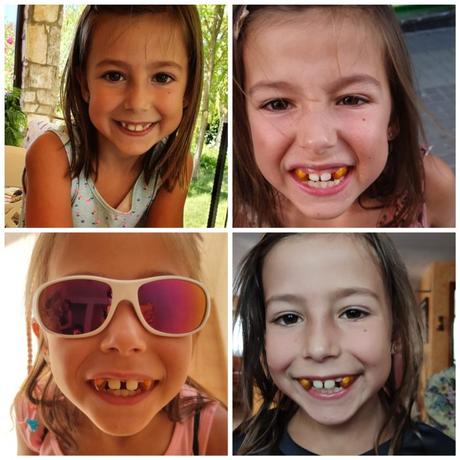 Experiencia: le ponen a mi hija aparato con 7 años Experiencia: le ponen a mi hija aparato con 7 años