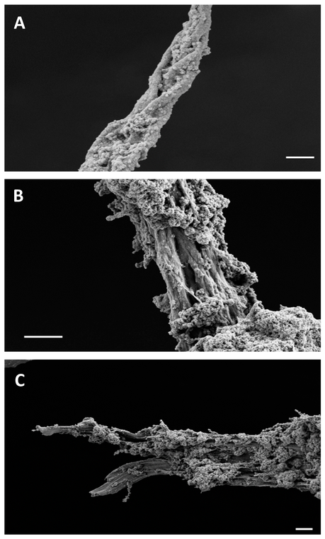 Las enzimas como modelo de estudio de la formación de fibras amiloides Ijms 25 08536 g006
