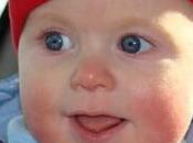 Tips para cuidados piel atópica bebés