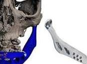 Mandíbula artificial creada impresora