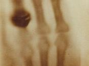 Radiografia fidelidad