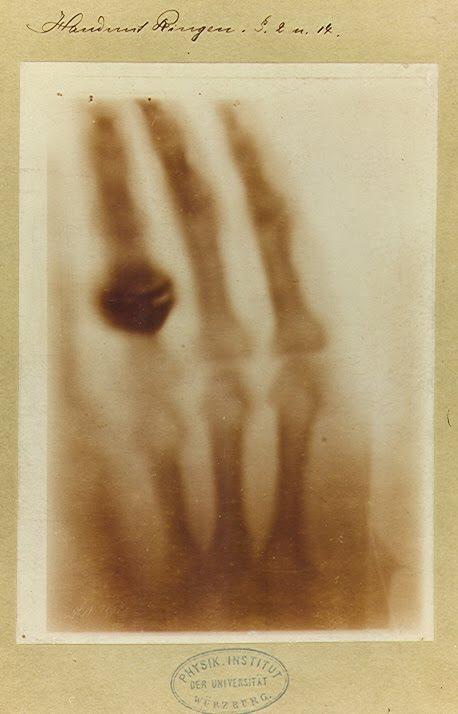 Radiografia de la fidelidad