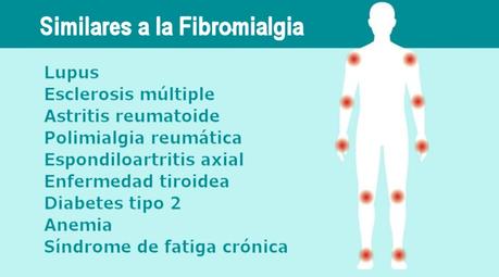 artritis reumatoide fibromialgia