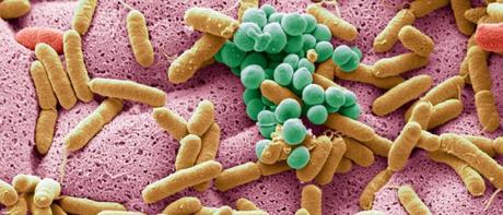 Artritis y microbiota intestinal Artritis y microbiota