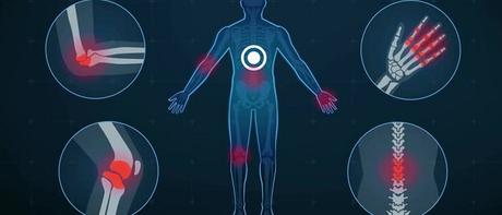 Inyecciones de cortisona para la artritis cortisona