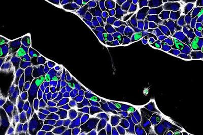 La Clamidia puede colonizar e instalarse en el intestino La Clamidia puede colonizar e instalarse en el intestino