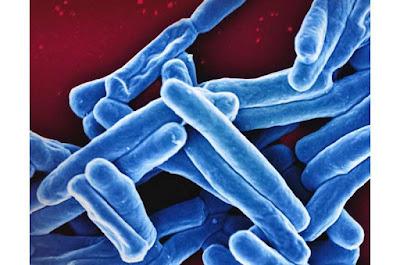 Nuevos hallazgos dan pauta de como tratar la tuberculosis