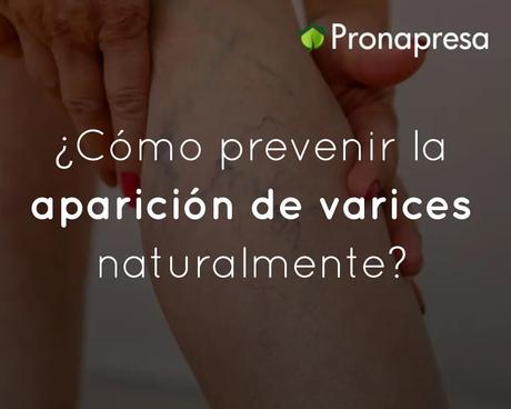 ¿Cómo prevenir la aparición de varices naturalmente?