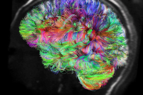 DESAPRENDER(SE) para decir de nuevo,  VEN...