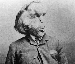 LA VERDADERA HISTORIA DEL HOMBRE ELEFANTE (1980), DE MICHAEL HOWELL Y PETER FORD. DONDE EL LECTOR CONOCE A UN HOMBRE MUY HUMANO.