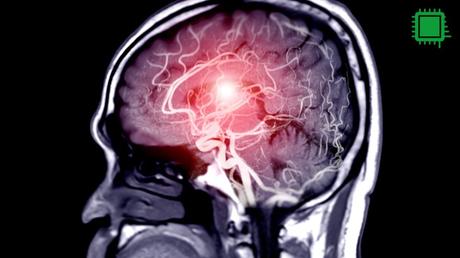 ¿Es posible predecir el crimen? La neuropredicción y sus desafíos neuropredicción