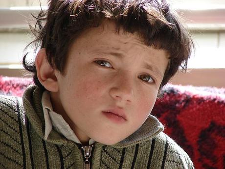 epileptico El 1% de los niños en EEUU tiene epilepsia