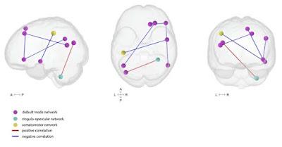 El ejercicio físico de hoy impulsara grandes ideas en 7 días El ejercicio físico de hoy impulsara grandes ideas en 7 días