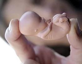 Justificar de forma lógica el aborto Justificar de forma lógica el aborto