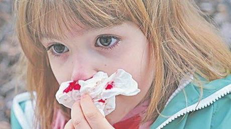 Mi peque sangra a menudo por la nariz