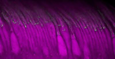 La terapia génica restaura la audición y mejora la visión