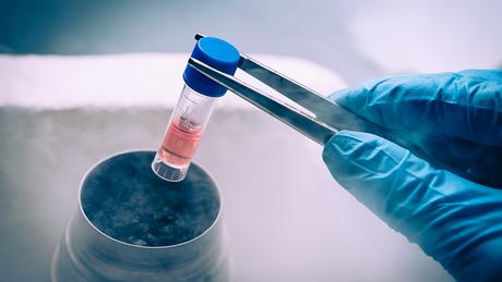 Un tratamiento con células madre ofrece esperanzas a las personas ciegas Un tratamiento con células madre ofrece esperanzas a las personas ciegas