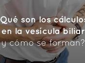 ¿Qué cálculos vesícula biliar cómo forman?
