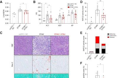 Nuevo enfoque para tratar las enfermedades hepáticas Nuevo enfoque para tratar las enfermedades hepáticas