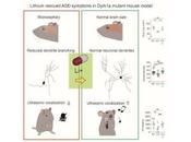 litio muestra prometedor tratamiento autismo