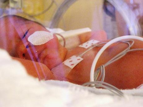 En partos prematuros la cesárea no es siempre la mejor opción