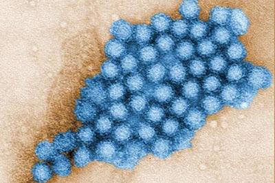 El Norovirus qué debe usted saber y cómo evitarlo