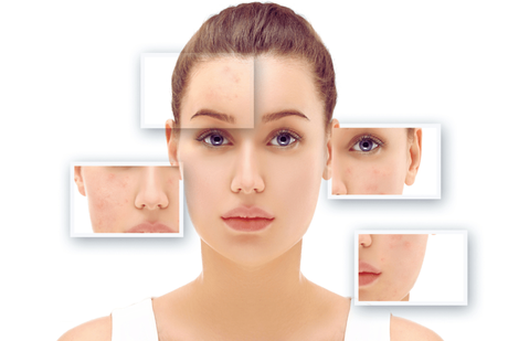 El ácido tranexámico y su impacto en el cuidado de la piel El ácido tranexámico y su impacto en el cuidado de la piel