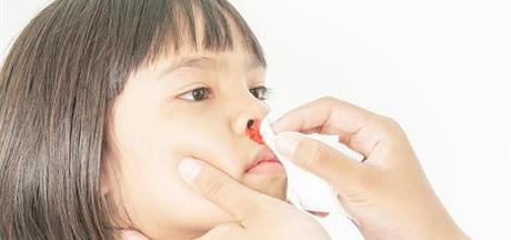 Porque mi hijo sangra a menudo por la nariz