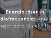 Energía láser radiofrecuencia: ¿qué mejor para celulitis?