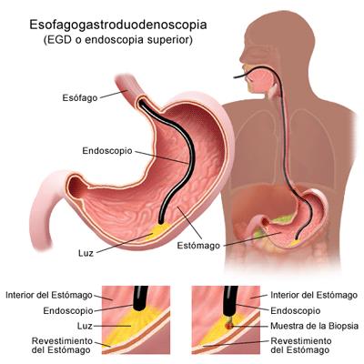 Principales causas y características de las hemorragias digestivas Principales causas y características de las hemorragias digestivas