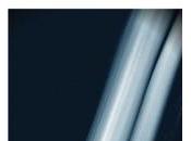 Dream Scary Dennis (2012)