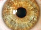 Lente fáquico para mejorar visión