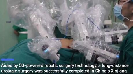 Cirujano chino realiza con éxito una cirugía robótica a 5.000 kilómetros de distancia