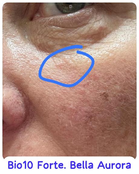 bio10-FORTE-BELLAAURORA bio10-FORTE-BELLAAURORA