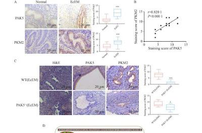 Nuevo objetivo terapéutico para tratar la endometriosis
