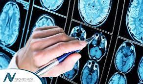 Un nuevo sistema adapta la estimulación al cerebro para mejorar los trastornos del movimiento en pacientes con párkinson