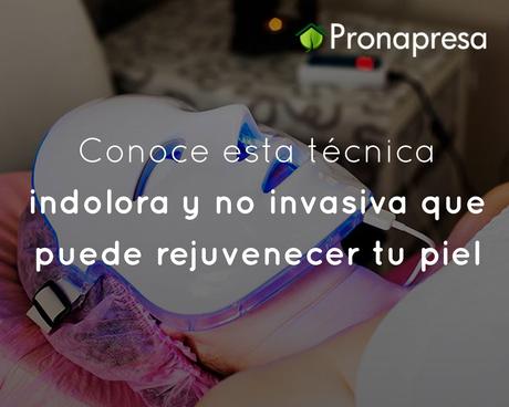 Conoce esta técnica indolora y no invasiva que puede rejuvenecer tu piel