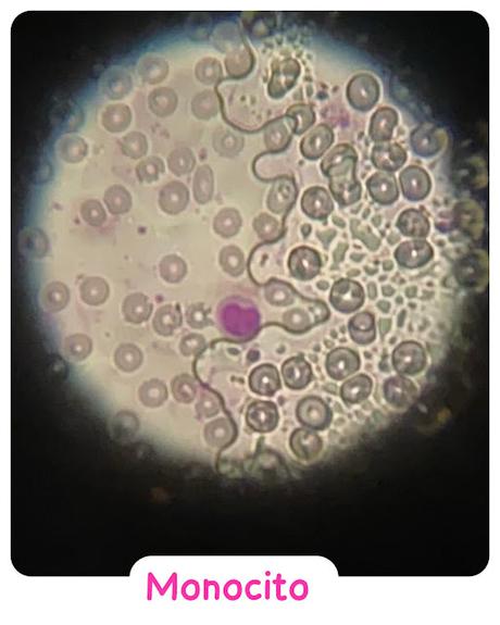 Monocito