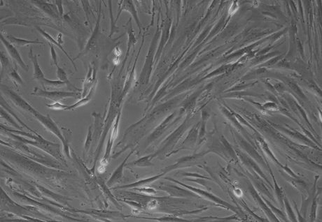 Edición genética CRISPR contra el cáncer: eliminando una mutación en FOXL2 para frenar tumores ováricos Edición genética CRISPR contra el cáncer: eliminando una mutación en FOXL2 para frenar tumores ováricos